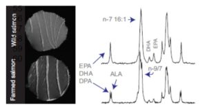 laks_mri